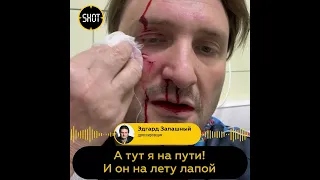 Наложили 14 швов: перенесший операцию после нападения тигра Эдгар Запашный рассказал о последствиях