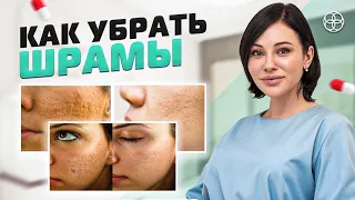 Рубцы и Шрамы | Методы лечения шрамов и рубцов | СОВЕТ КОСМЕТОЛОГА