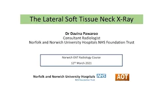 Head & Neck | Lateral Soft Tissue Neck X-Ray | Dr Davina Pawaroo