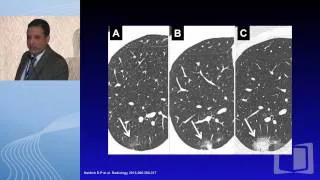 Screen discovered nodules: What next?