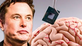 LEAKED: Elon Musk Wants to Implant a Chip In Your Brain!