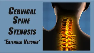 Best Exercises for Stenosis in the Cervical Spine | Slower Pace and More Reps