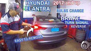 How to replace Light bulbs, turn signal and other bulbs on 2018 Hyundai Elantra