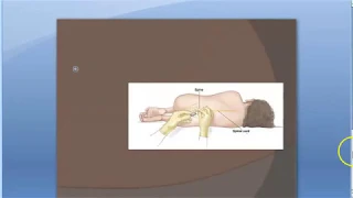 Pathology 999 c Tuberculous meningitis CSF Mycobacterium lymphocytes Case Study