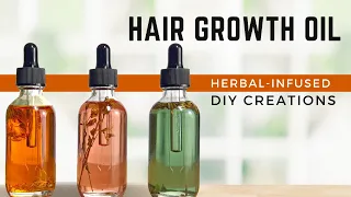 3 DIY Hair Growth Oils | Fight DANDRUFF, ECZEMA, SEBORRHEIC PSORIASIS, & MORE