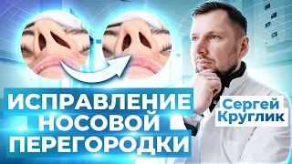 Септопластика / Как устранить искривление носовой перегородки?