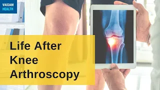 Life After Knee Arthroscopy