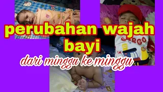 Perubahan wajah bayi dari minggu ke minggu