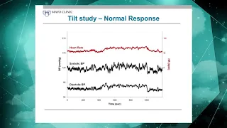 Tilt Table Testing (6 of 16)