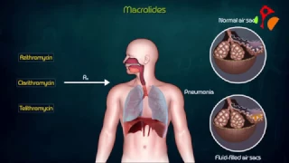 Macrolides Antibiotics Animated presentation- Mechanism of action , Kinetics , Resistance : USMLE