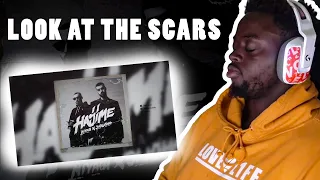 Miyagi & Эндшпиль - Look at the Scars (Official Audio) REACTION