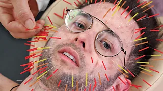 Zach Tries 1000 Needle Acupuncture