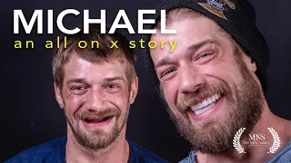 Michael's Full All on X Journey | Emotional Smile Reveal