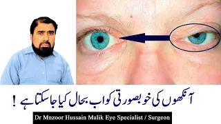 Dermatochalasis and Blepharochalasis Symptoms & Treatment Urdu/Hindi