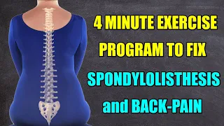 A 4 MINUTE EXERCISE PROGRAM TO FIX SPONDYLOLISTHESIS and BACK PAIN