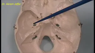 Osteology of the skull: 6 cranial cavity