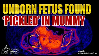 Unborn Fetus Found Preserved Inside Mummy! How Is That Possible?