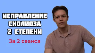 Сколиоз|Лечение СКОЛИОЗА у взрослых|Искривление ПОЗВОНОЧНИКА|Мануальный терапевт в Сургуте