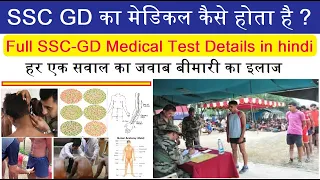 SSC GD का मेडिकल कैसे होता है ? Full SSC-GD Male Female Medical Test Details in Hindi complete.