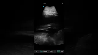 Elephant Ultrasound Highlights