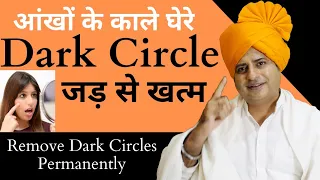 आँखों के काले घेरे जड़ से ख़त्म करें, Remove Dark Circles Permanently || Sanyasi Ayurveda ||