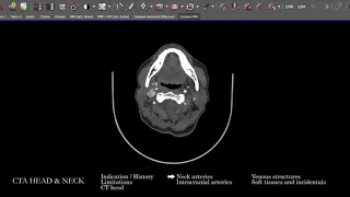 [CT] CTA Head and Neck | Search Pattern