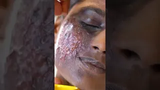 Acid burn face makeup look by Rajkrish.... contact +918884532563 ... Pro makeup course