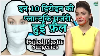 10 Bollywood Celebrities Plastic Surgery GONE Terribly Wrong | हिंदी