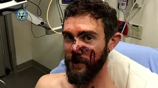 Colorado Man, Travis Kauffman, Survives Mountain Lion Attack