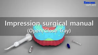 Implant impression using contents.