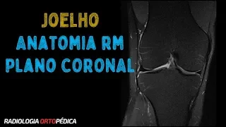 Anatomia RM do Joelho - Plano  Coronal