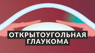 👁️ Открытоугольная глаукома 👁️ 5 фактов об открытоугольной глаукоме! Доктор Лапочкин