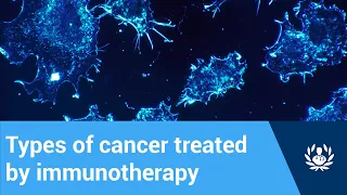 What types of cancer can immunotherapy treat?