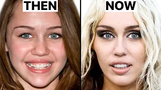 What Happened to Miley Cyrus' Face? | Plastic Surgery Analysis