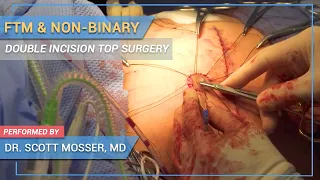 LIVE SURGERY of Transgender FTM/Non-Binary DOUBLE INCISION Top Surgery Performed by Dr. Mosser