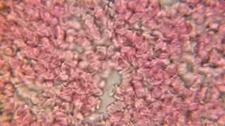 Blood on 1000x Microscope HD 1080p