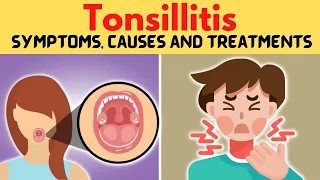 Tonsillitis Symptoms, Causes and Treatments