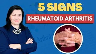 5 Symptoms of Rheumatoid Arthritis That You Should Know About