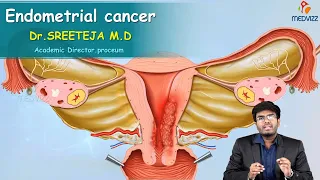 Endometrial Cancer : Obstetrics and gynaecology Video lectures Version 2.0 ( Medvizz app )