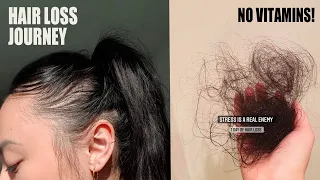 STRESS was THINNING my hair 💔 Hair Update |  My Hair Loss Journey