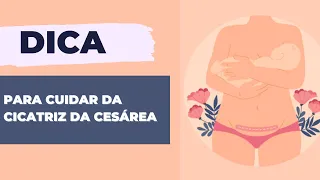 5 DICAS PARA CUIDAR DA CICATRIZ DA CESÁREA