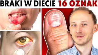 Zdrowie wypisane na ciele: 16 oznak niedoborów w diecie | Dr Bartek Kulczyński