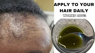 This Hair Growth Recipe Broke the Internet in One Week! See what Happens to your hair!May 9, 2024