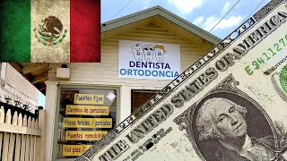 Где американцы лечат зубы? Тихуана, Мексика - опыт посещения стоматолога