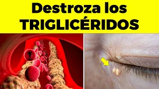 ¡ESTA es LA MEJOR HIERBA Para BAJAR los TRIGLICÉRIDOS DE forma natural!