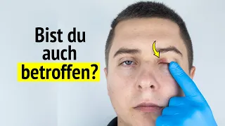 👉 Vitamin B12 Mangel: Diese 4 Symptome bedrohen deine Gesundheit