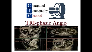 فحص  TRI phasic Angioعلى جهاز GE 64 Slice