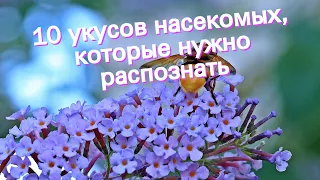 10 укусов насекомых, которые нужно распознать