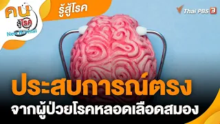 ประสบการณ์ตรงจากผู้ป่วยโรคหลอดเลือดสมอง | รู้สู้โรค