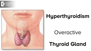Hyperthyroidism | Overactive Thyroid Gland causes, signs, symptoms, treatment-Dr.Karthik Prabhakar